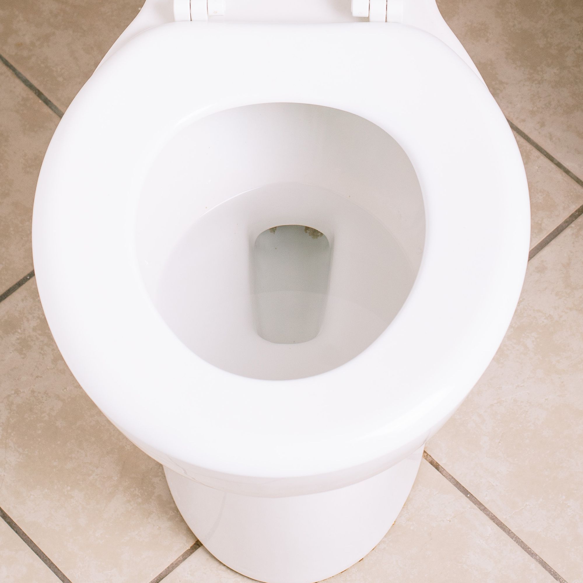 Fresno man glued to toilet in prank gone wrong